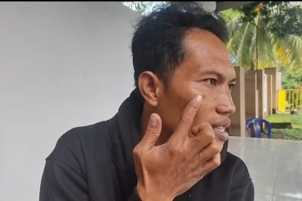 Kondisi pipi korban, Hasan Makbul Akbar korban penganiayaan. Foto. Ist