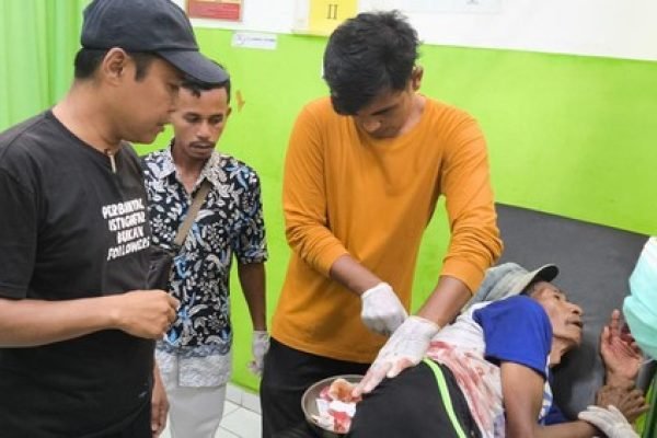 Salah korban pembacokan dirawat di Puskesmas Sanggar, Bima.